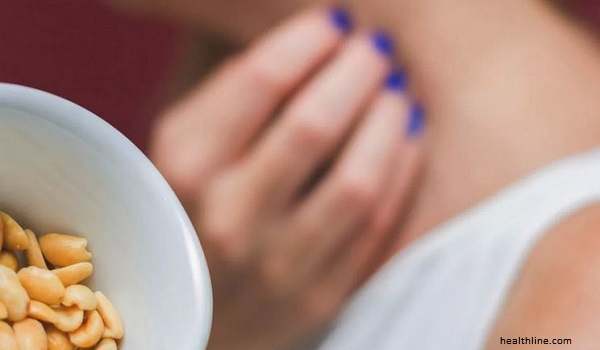Anda Mengira Memiliki Alergi Makanan, Belum Tentu